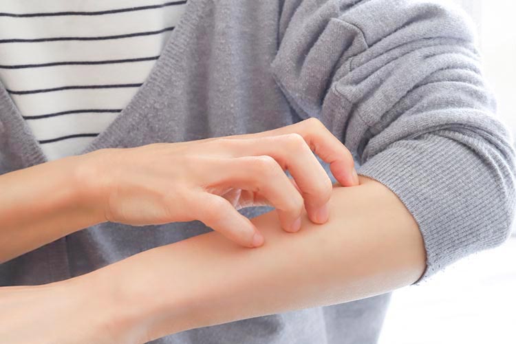 アレルギー疾患